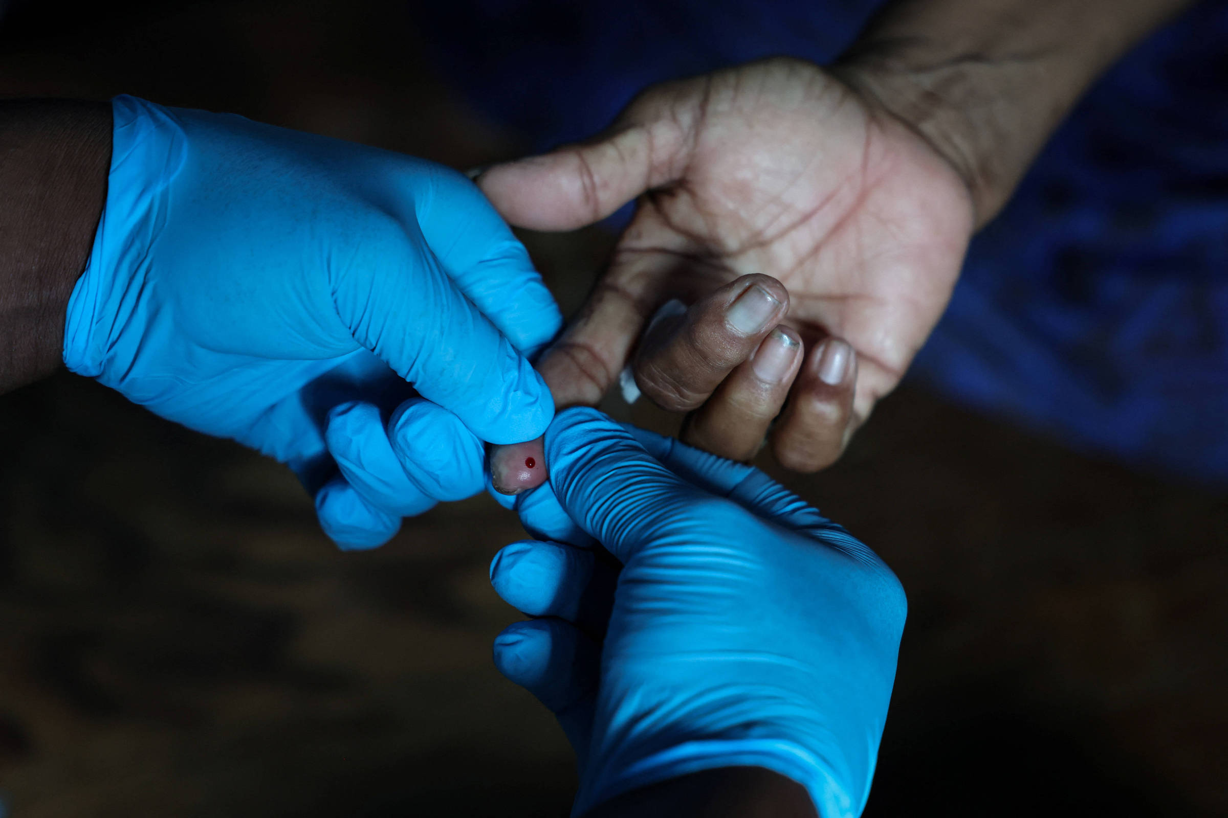 Por que diabetes tipo 1 é mais grave em crianças pequenas - 14/11/2025 - Equilíbrio e Saúde