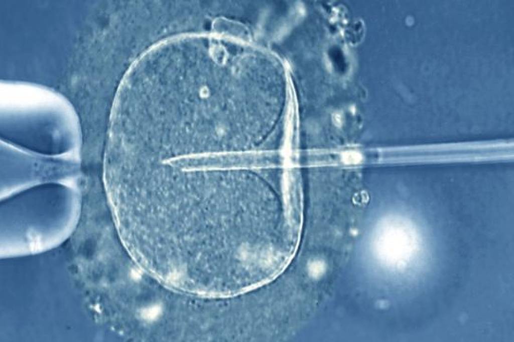 IA contribui para maior precisão da reprodução assistida - 22/12/2025 - Equilíbrio e Saúde