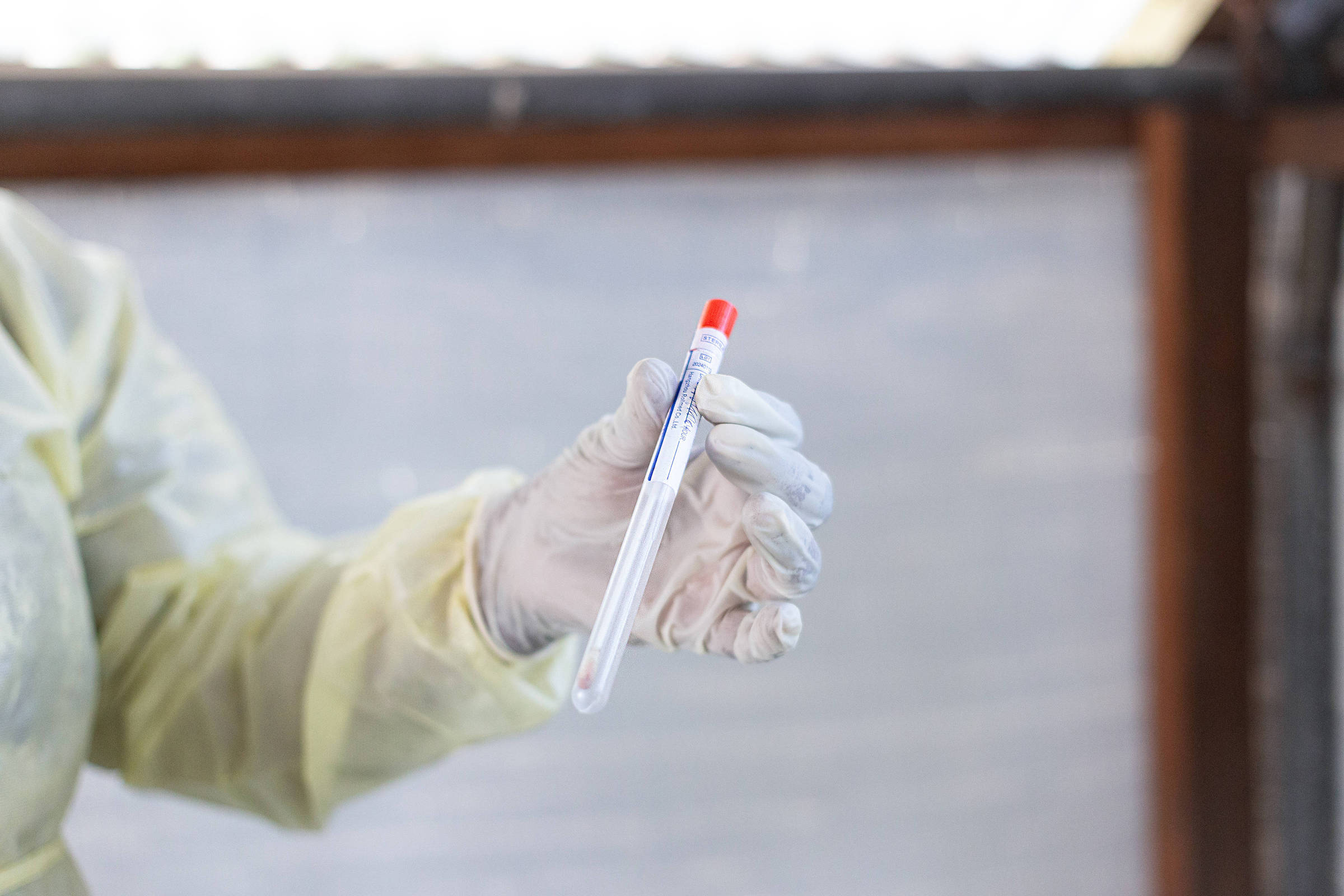Cientista é acusado de tentar contrabandear mpox nos EUA - 12/06/2026 - Equilíbrio e Saúde